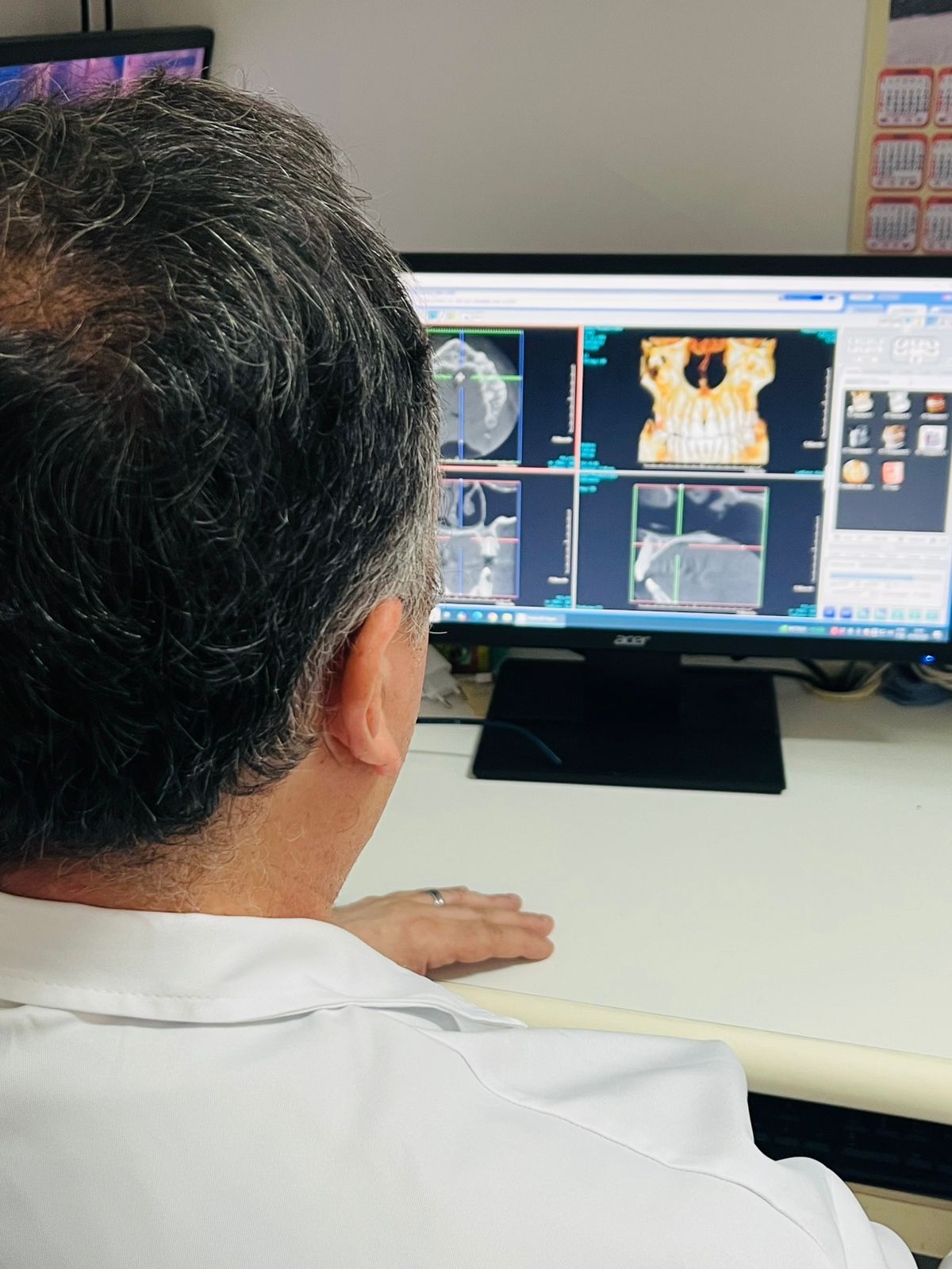 Tomografia Cone Beam